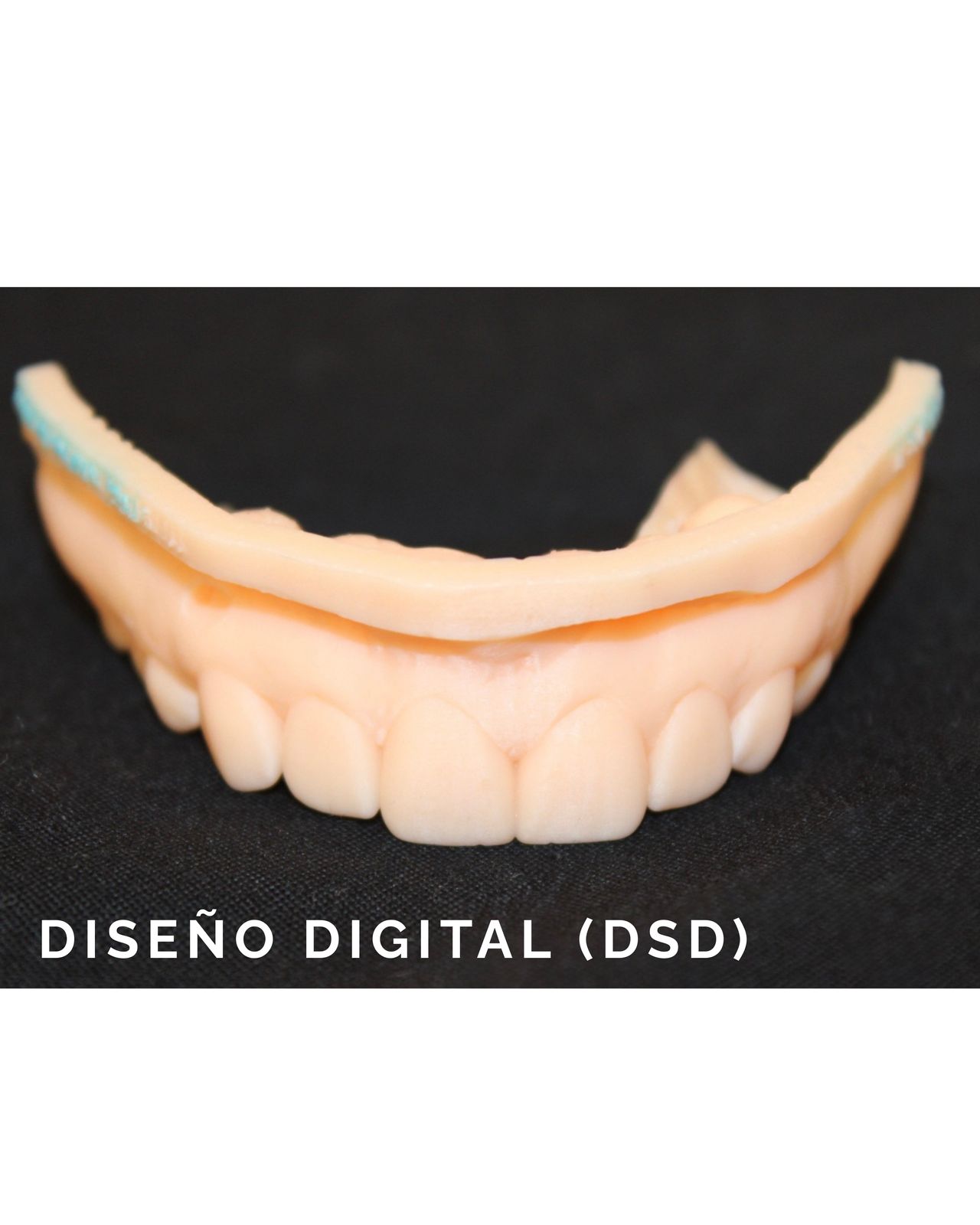 Diseño digital (DSD): Planeado antes de tocar un diente
